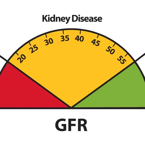 محاسبه آنلاین GFR