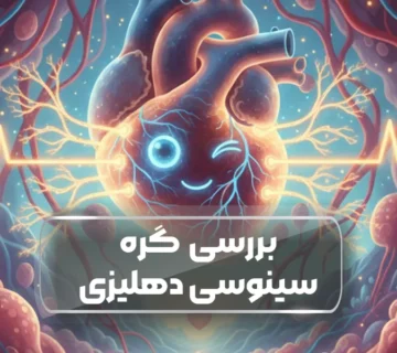 گره سینوسی دهلیزی (SA Node)